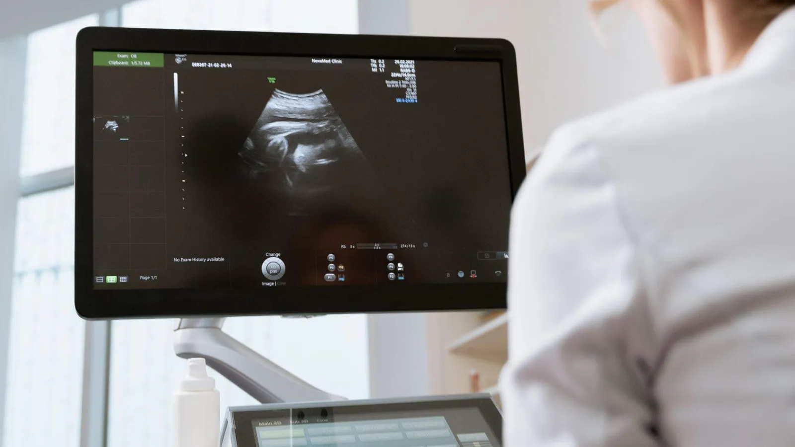 Ärztin blickt auf Ultraschallbild