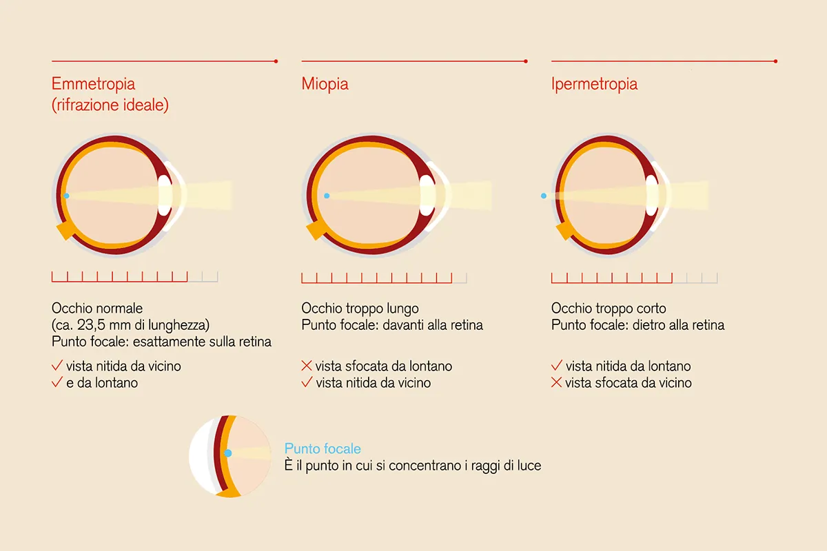 Grafik Sehhilfe